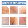 Oceaura Scar Whitening Repair Gel Moisturizes And Smooths Skin Repair Surgery Scar Pregnancy Care Gel